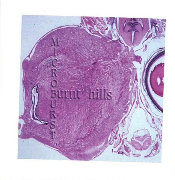 BURNT HILLS - Microburst