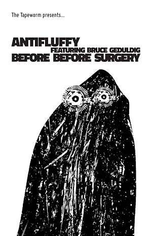 ANTIFLUFFY FEATURING BRUCE GEDULDIG - Before Before Surgery